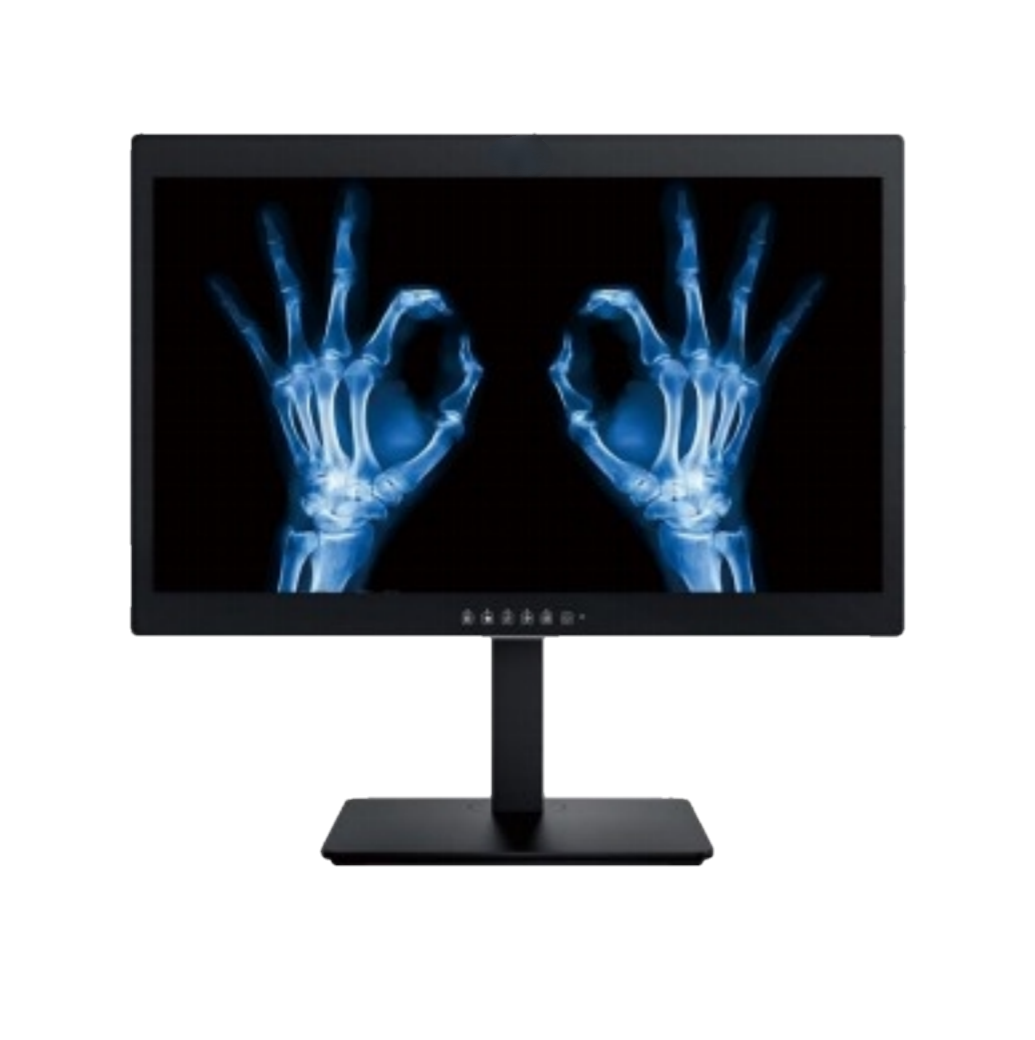 Bạn có nghĩ màn hình chẩn đoán y tế bệnh viện 24 inch 2MP chỉ là màn hình máy tính thương mại thông thường không?
