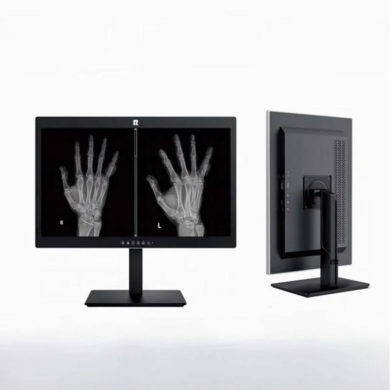 Màn hình chẩn đoán y tế 24 inch 2MP