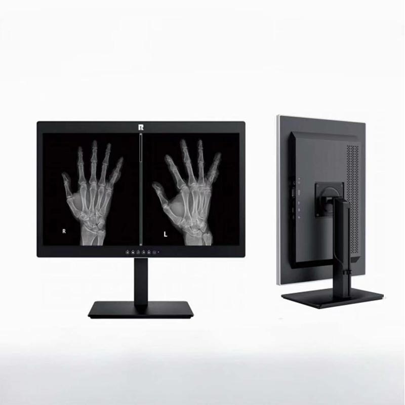 Màn hình chẩn đoán y tế 24 inch 2MP