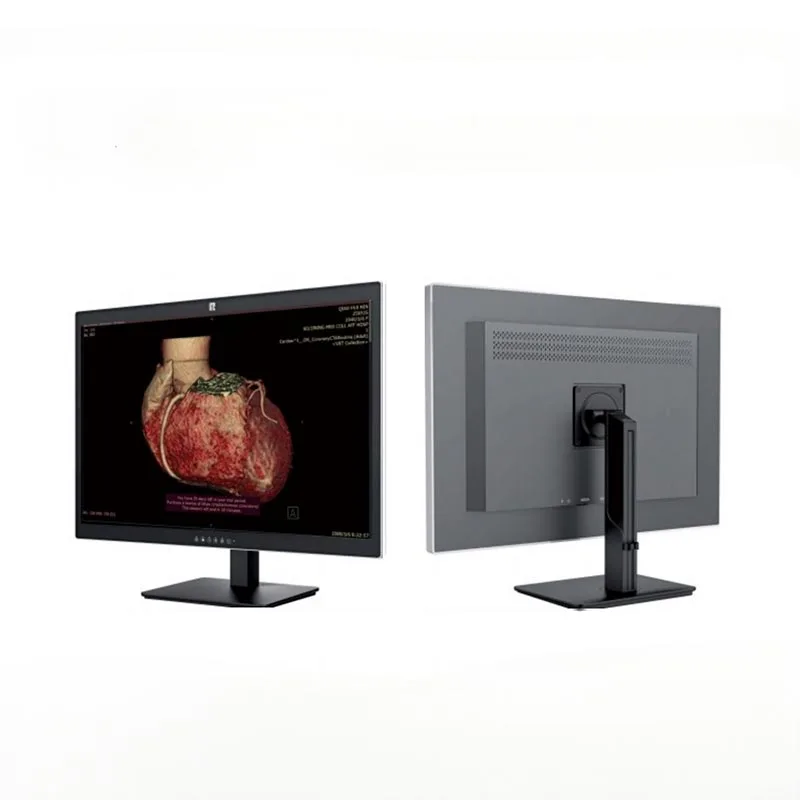 Màn hình chẩn đoán y tế 30 inch 6MP