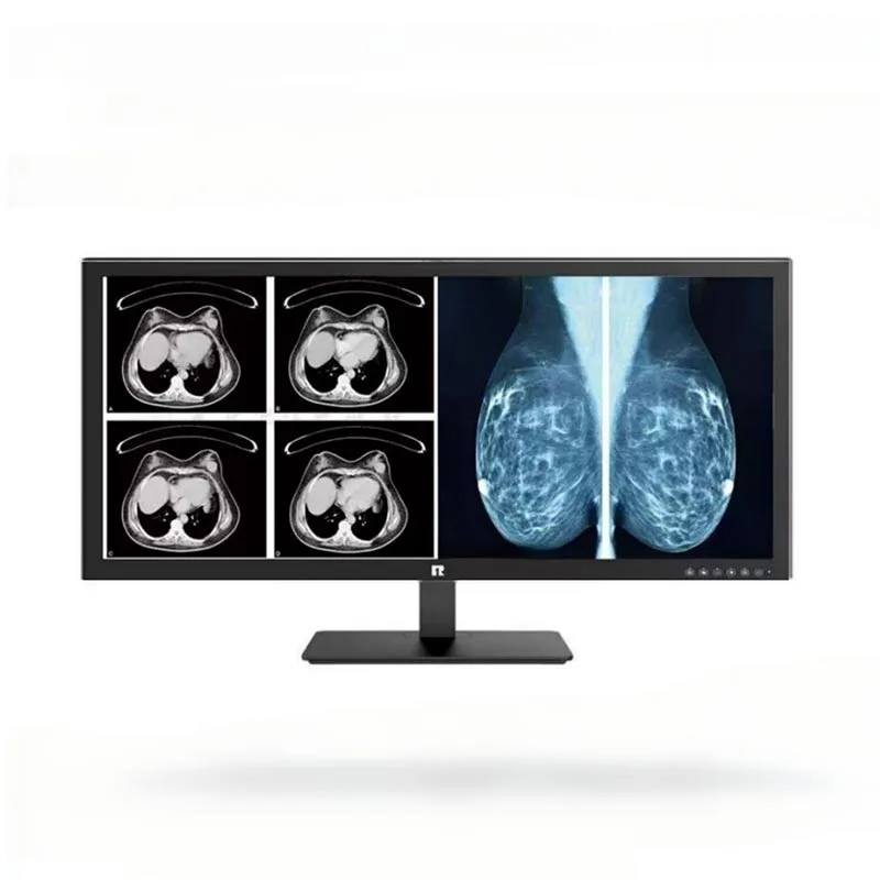 Màn hình chẩn đoán y tế 34 inch 5MP
