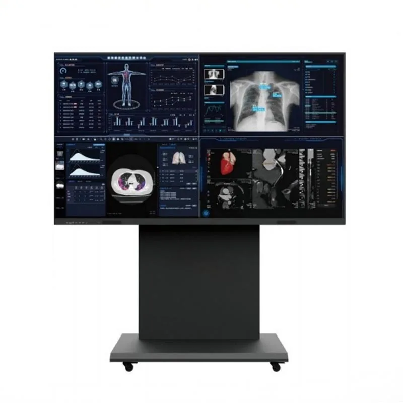 Thiết bị đầu cuối giám sát tư vấn y tế 86 inch 8MP