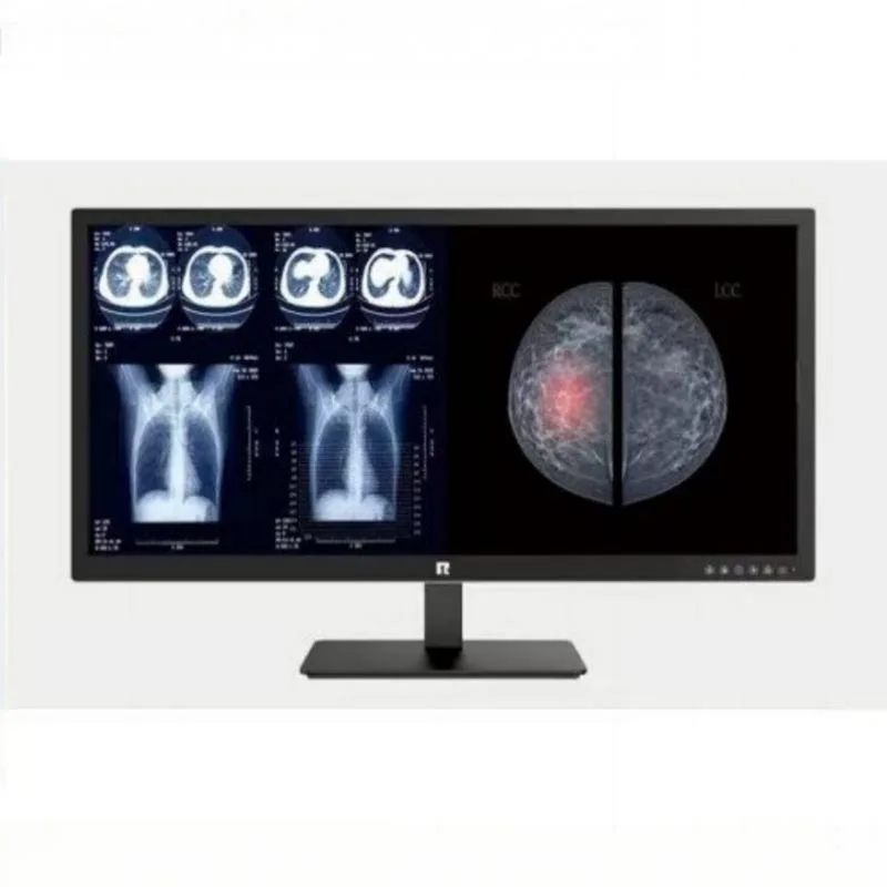 34-inch 5MP Medical Diagnostic Display